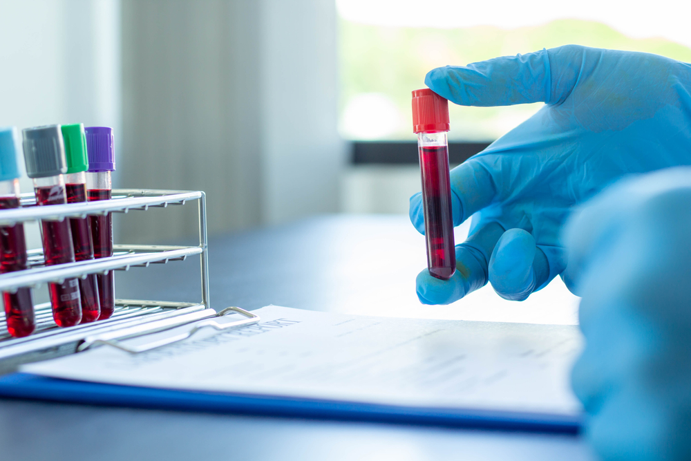 gloved hand holding test tube of blood